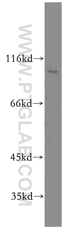 WB analysis of HepG2 using 12709-1-AP