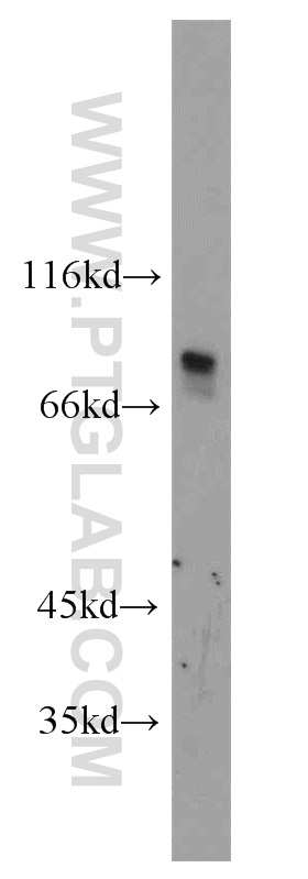 WB analysis of HepG2 using 14567-1-AP