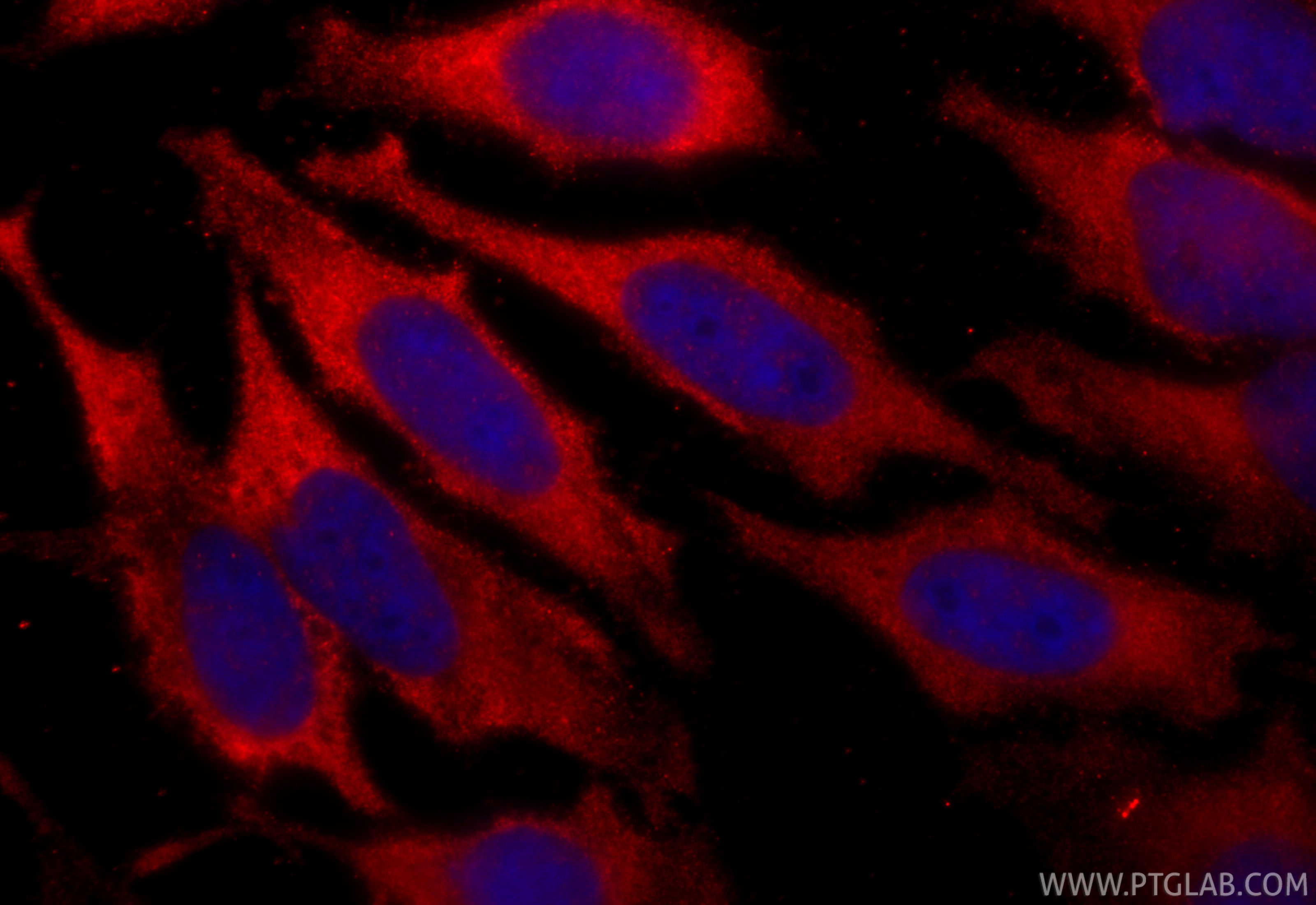 Immunofluorescent analysis of (-20°C Ethanol) fixed HeLa cells using RIOK1 antibody (17222-1-AP) at dilution of 1:400 and CoraLite®594-Conjugated Goat Anti-Rabbit IgG(H+L) (<a class='green' href='/productredirect?CatalogNo=SA00013-4' target='_blank'>SA00013-4</a>). IF Staining of HeLa using 17222-1-AP