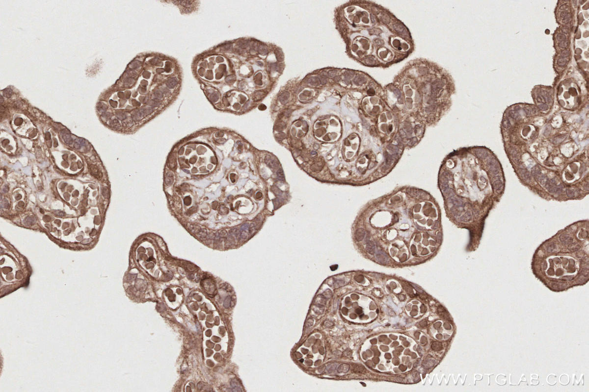 IHC staining of human placenta using 17222-1-AP