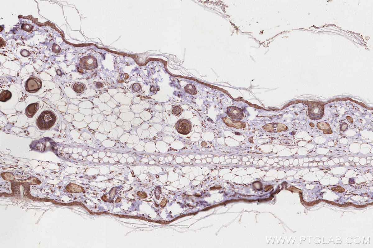IHC staining of rat skin using 17222-1-AP