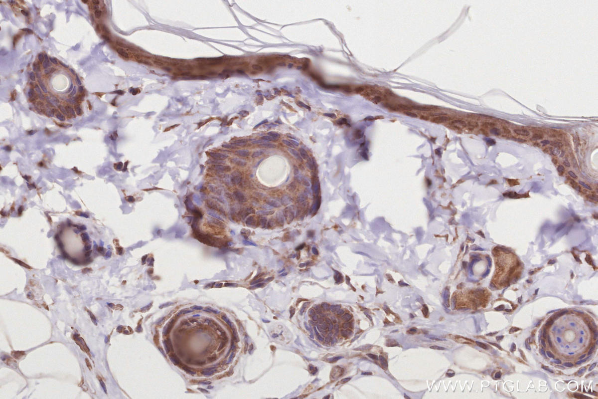 IHC staining of rat skin using 17222-1-AP