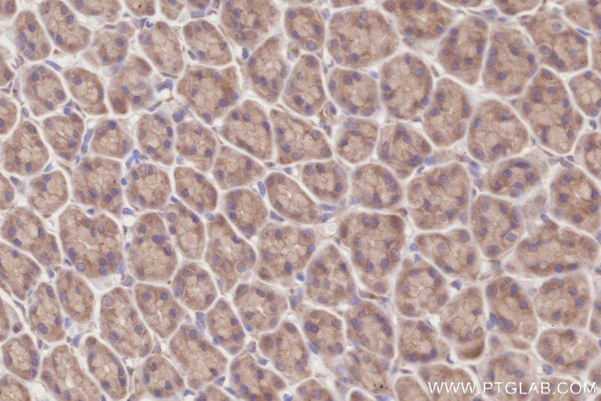 IHC staining of rat stomach using 17222-1-AP