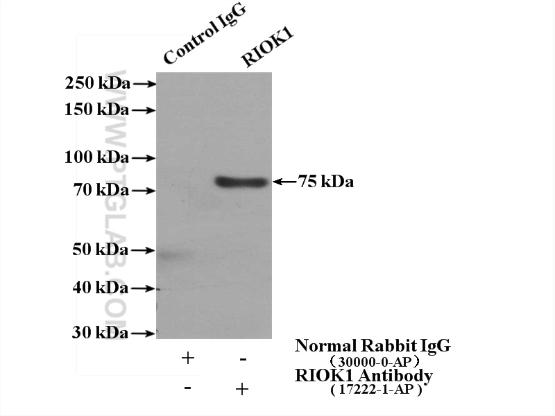 IP experiment of HeLa using 17222-1-AP