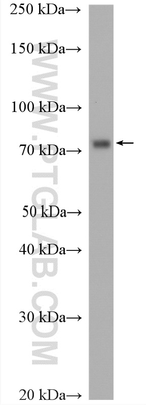 WB analysis of HeLa using 17222-1-AP