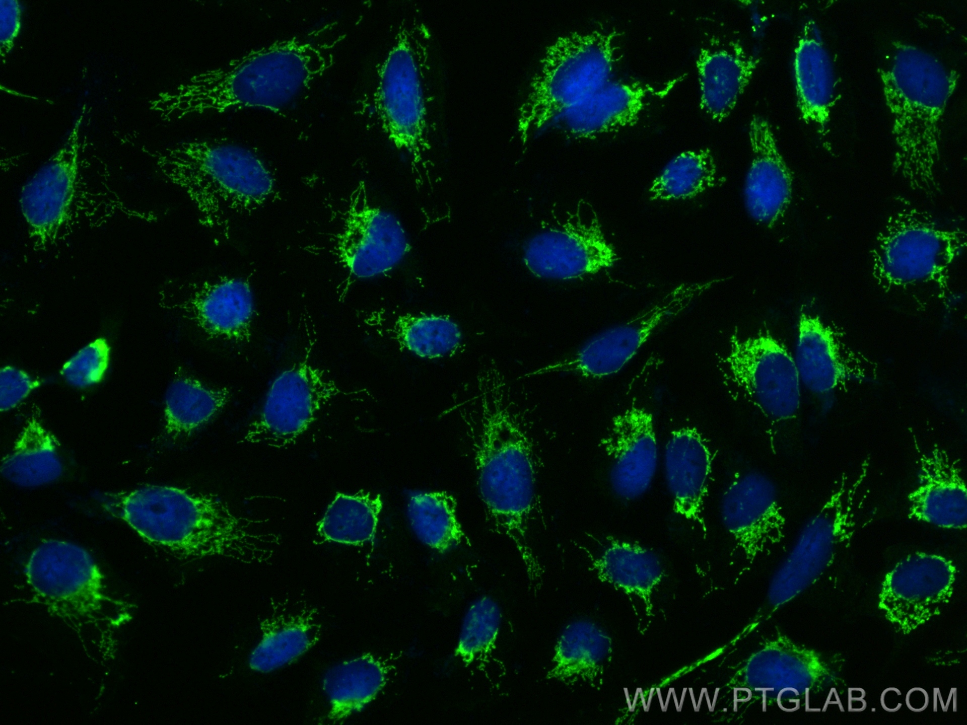 IF Staining of U2OS using 17410-1-AP