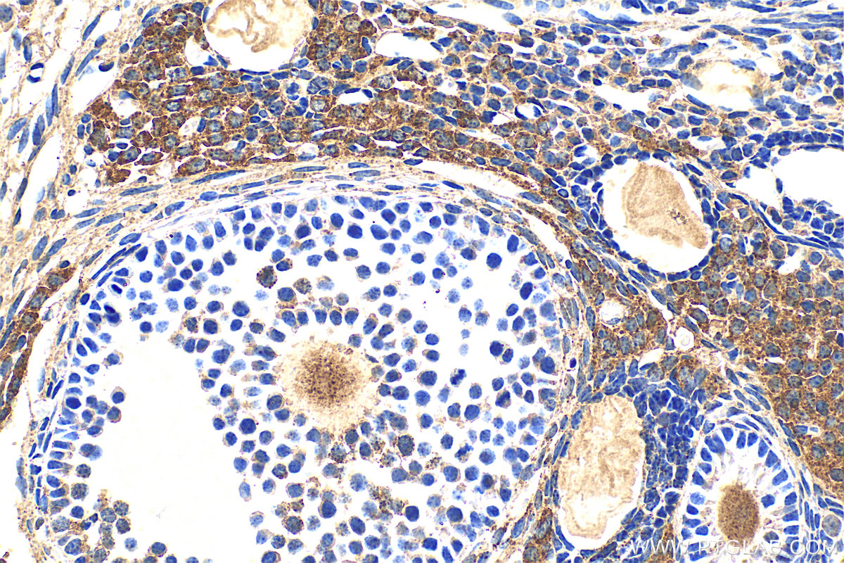 IHC staining of mouse ovary using 17410-1-AP