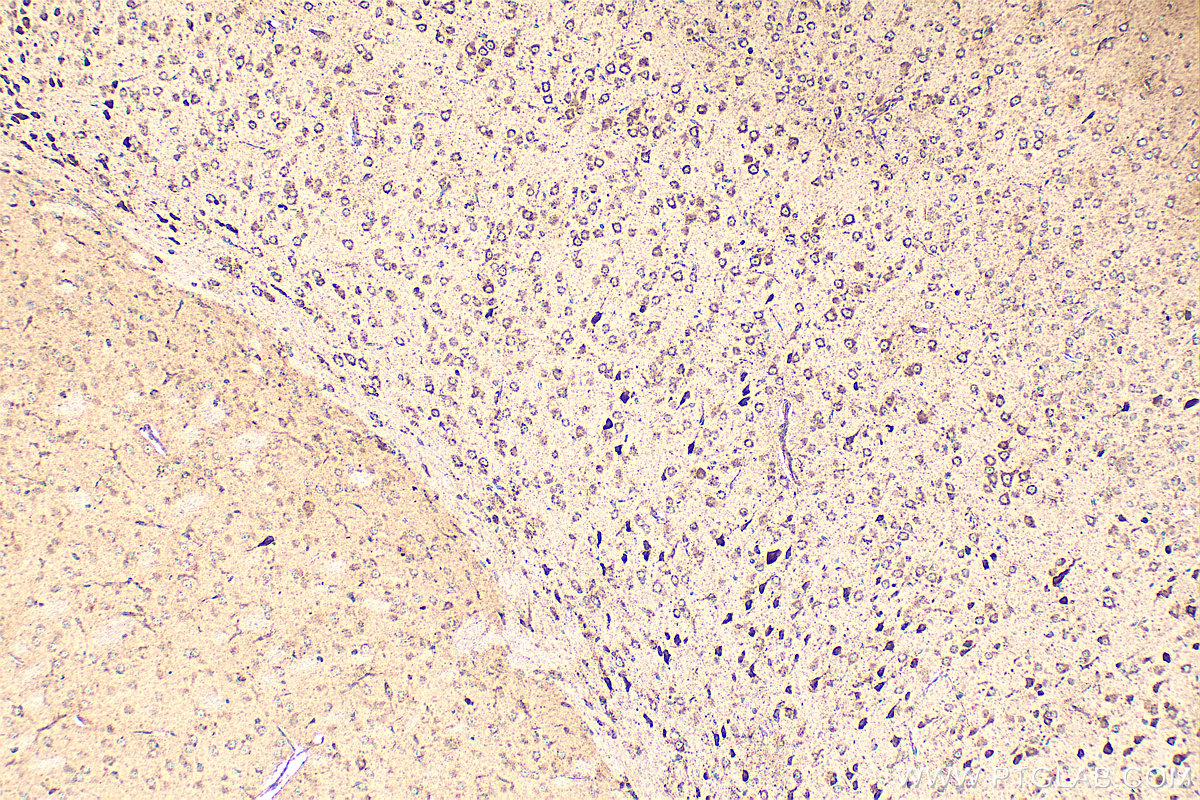 IHC staining of mouse brain using 17410-1-AP