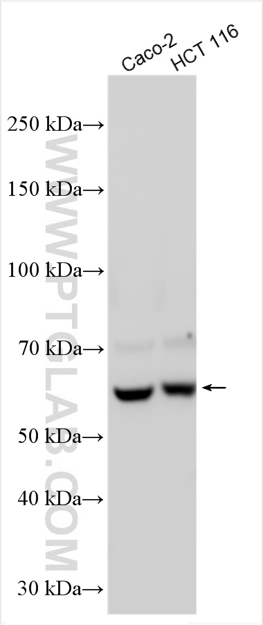 WB analysis using 17410-1-AP