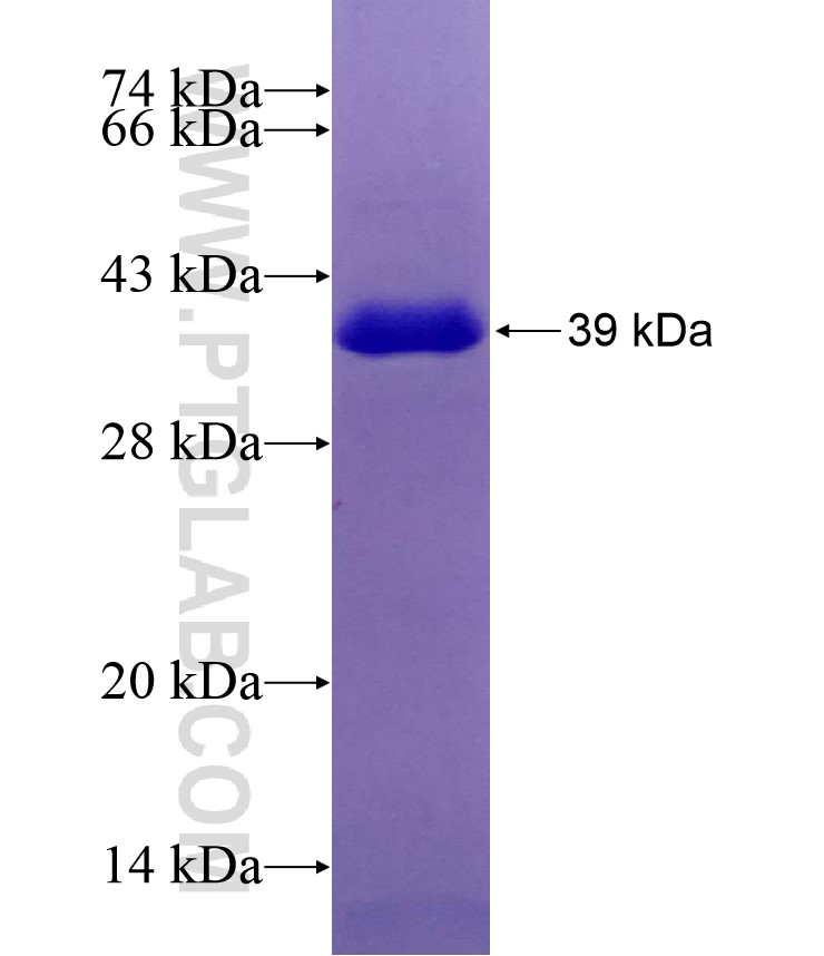 RIOK3 fusion protein Ag29019 SDS-PAGE RIOK3 fusion protein Ag29019 SDS-PAGE