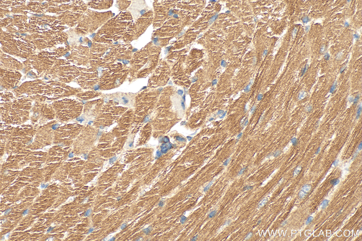 Immunohistochemical analysis of paraffin-embedded mouse heart tissue slide using 29932-1-AP (RIPK1 antibody) at dilution of 1:400 (under 40x lens). Heat mediated antigen retrieval with Tris-EDTA buffer (pH 9.0). IHC staining of mouse heart using 29932-1-AP