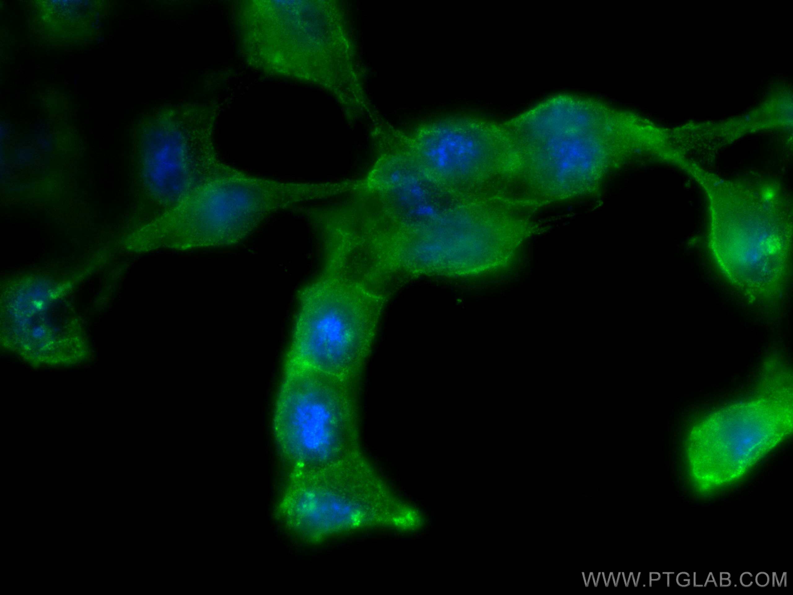 Phospho-RIPK1 (Ser161) 