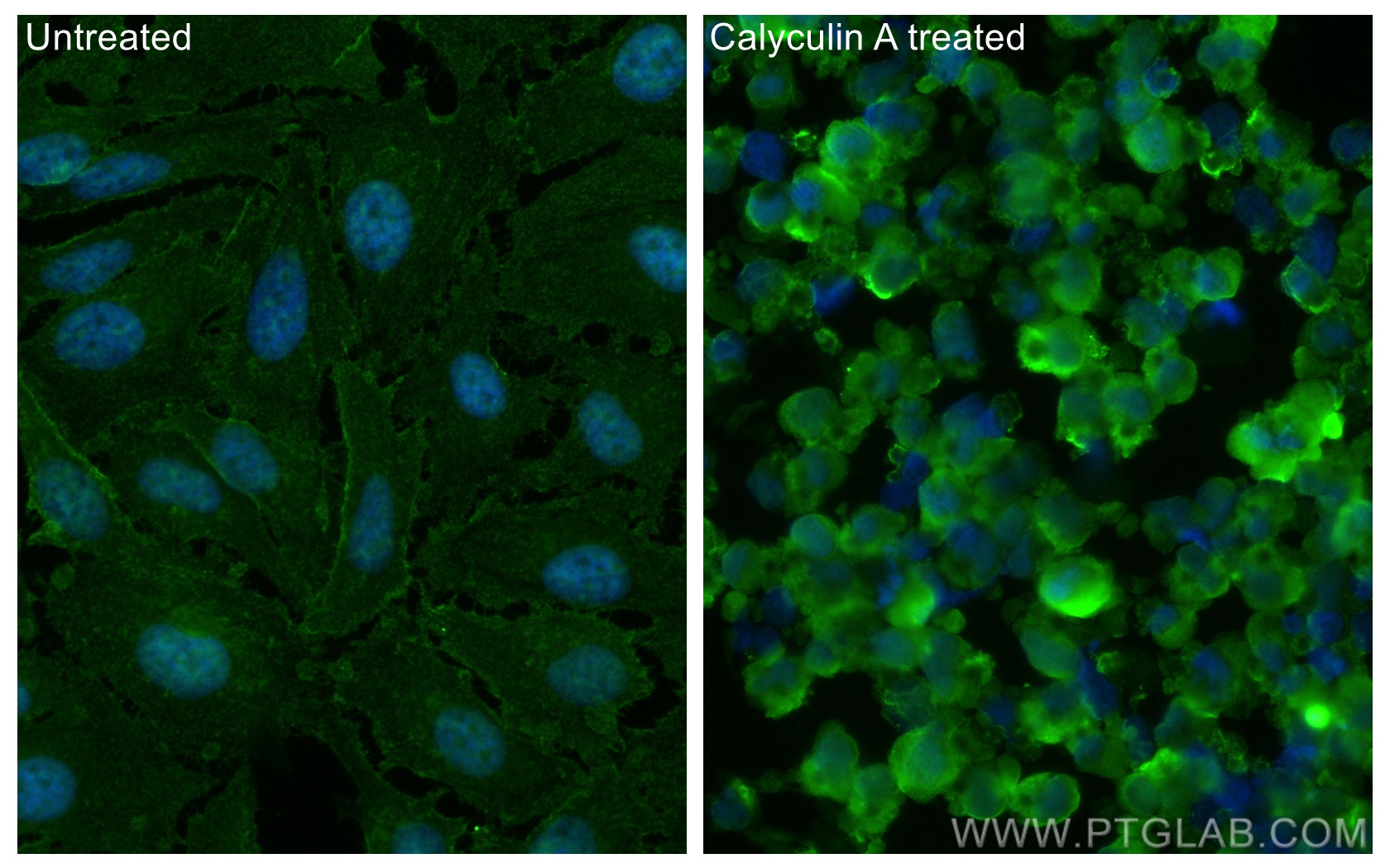 IF Staining of HeLa using 66854-1-Ig