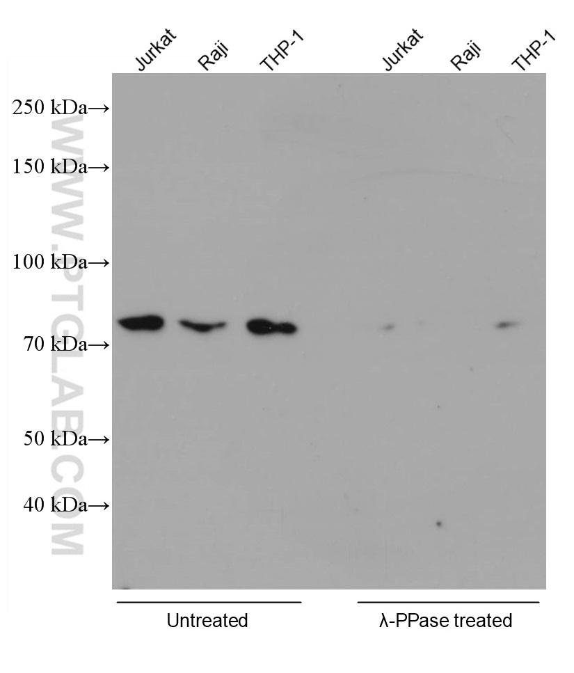 WB analysis using 66854-1-Ig