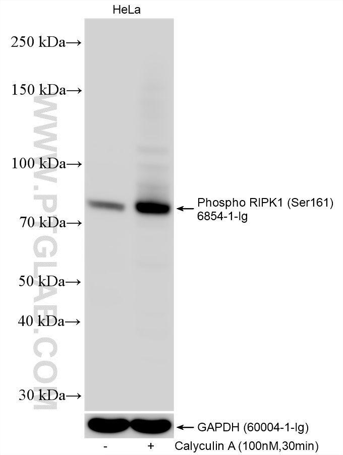 WB analysis using 66854-1-Ig