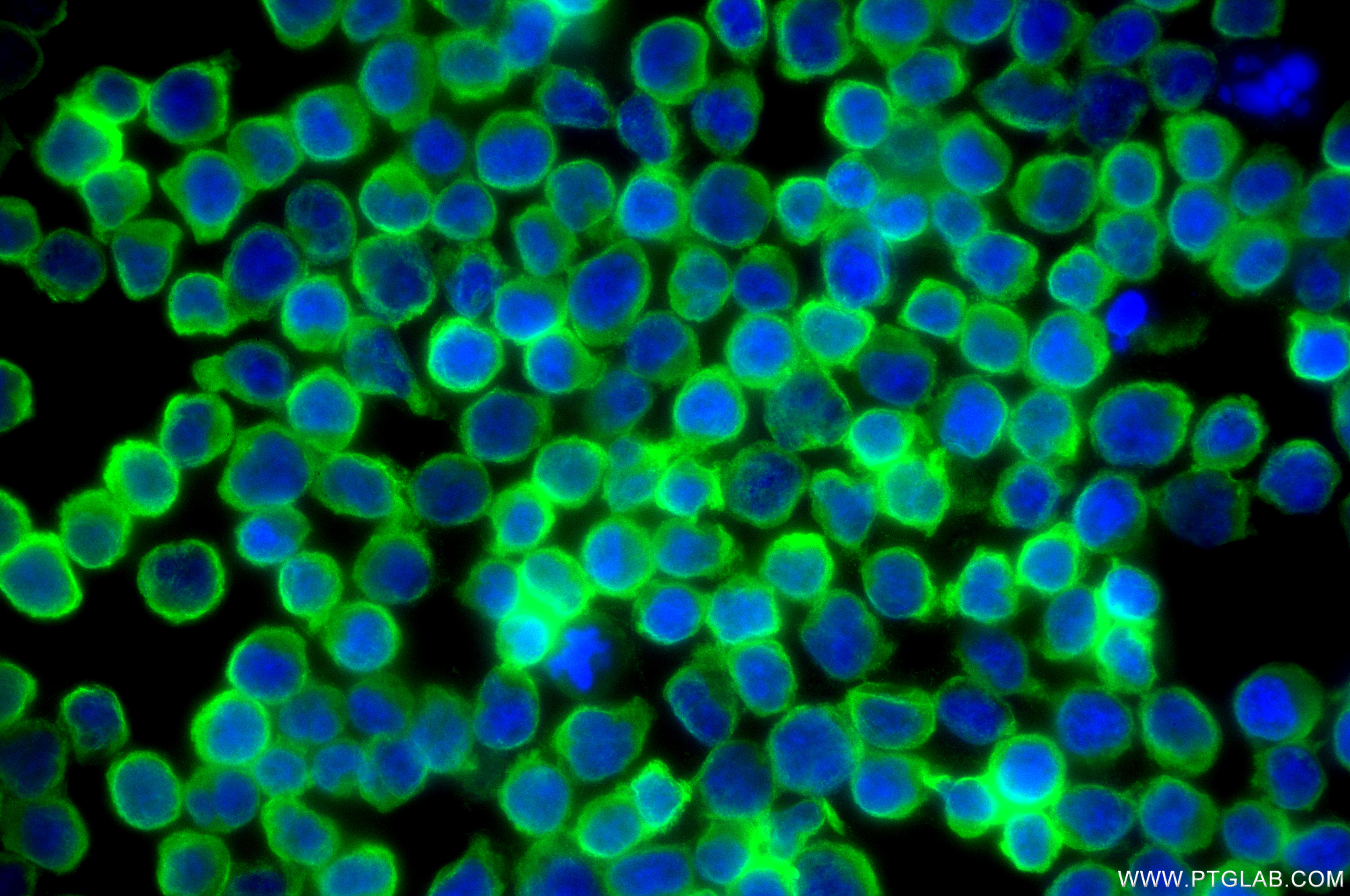 IF Staining of Jurkat using 85760-4-RR