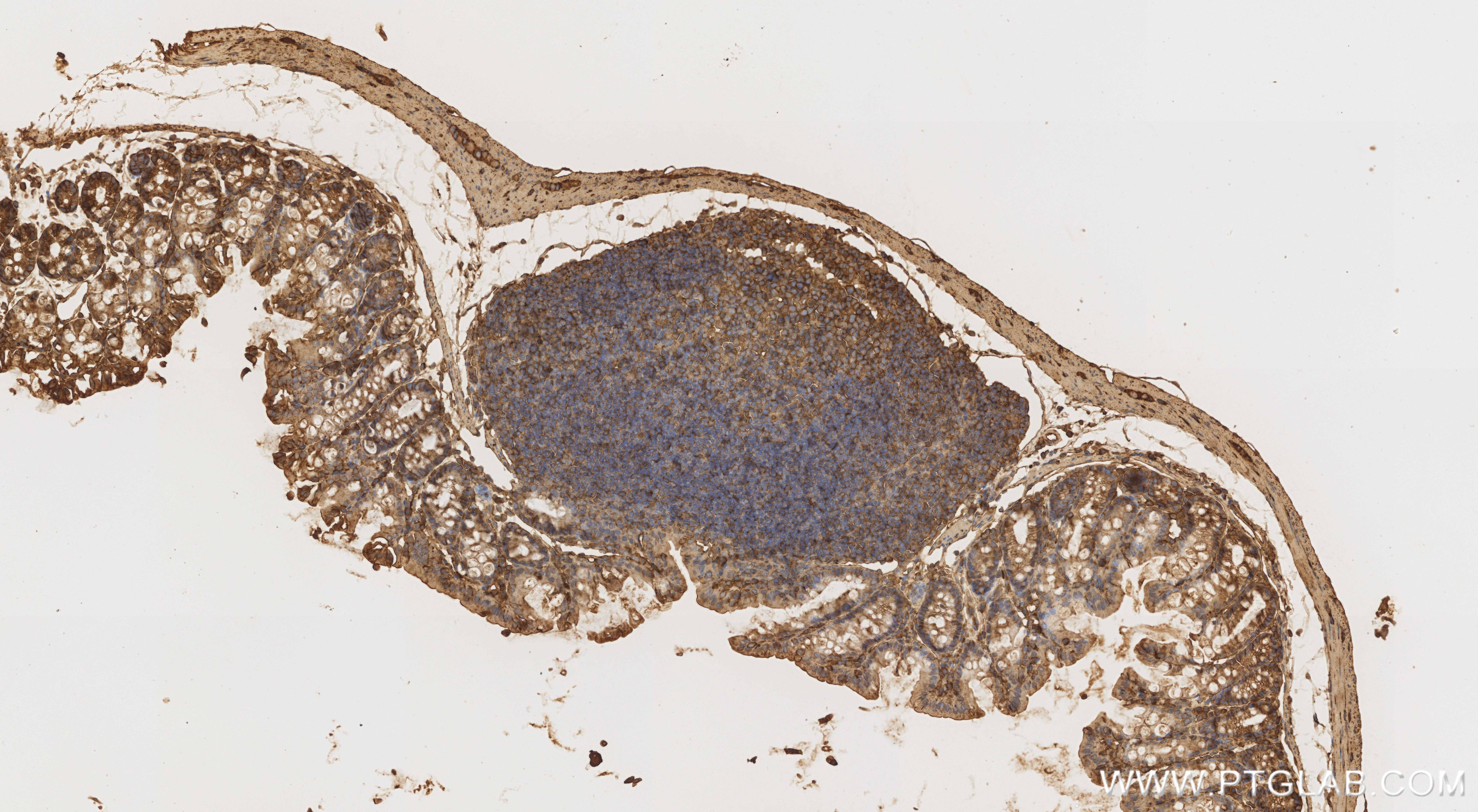 IHC staining of mouse colon using 85760-4-RR