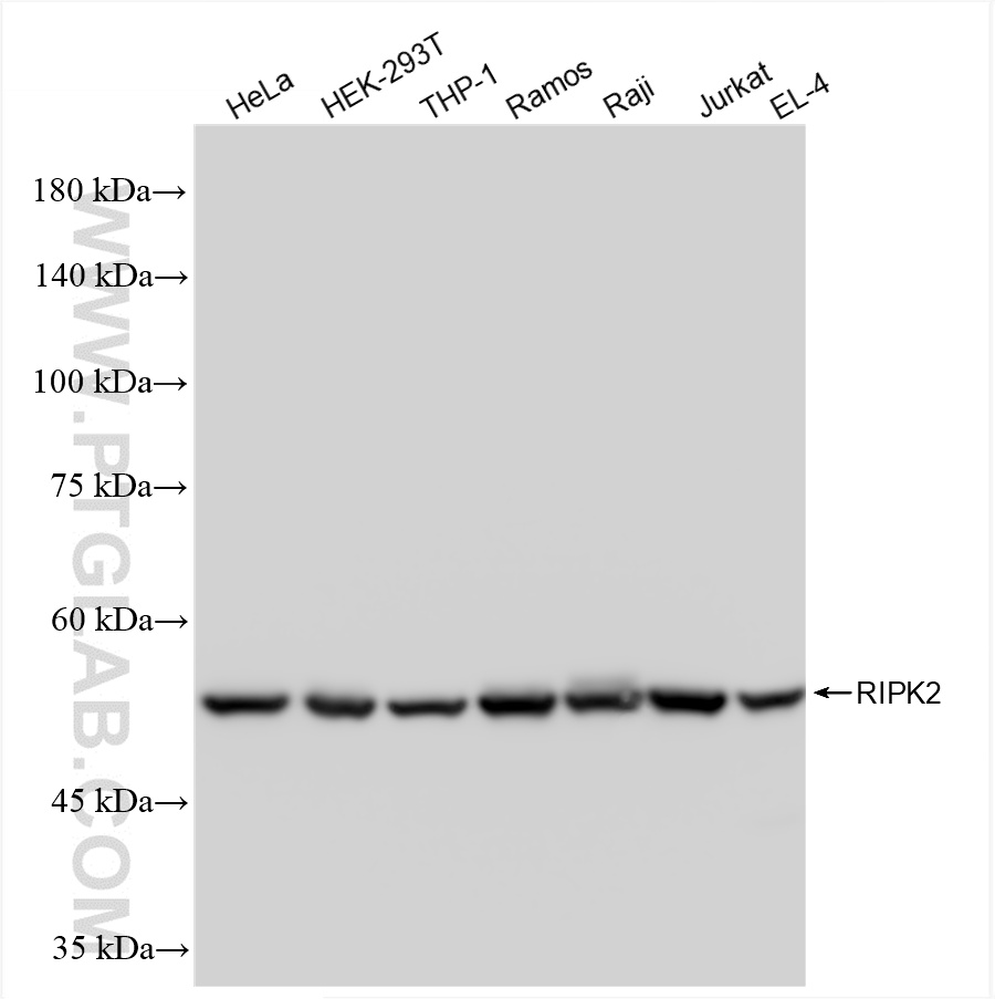 WB analysis using 85760-4-RR (same clone as 85760-4-PBS)