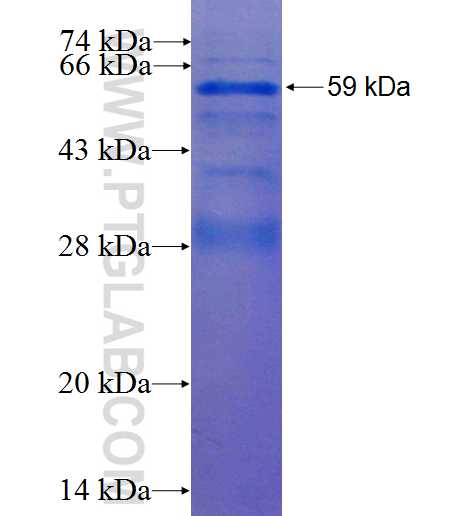RIPK2 fusion protein Ag0909 SDS-PAGE