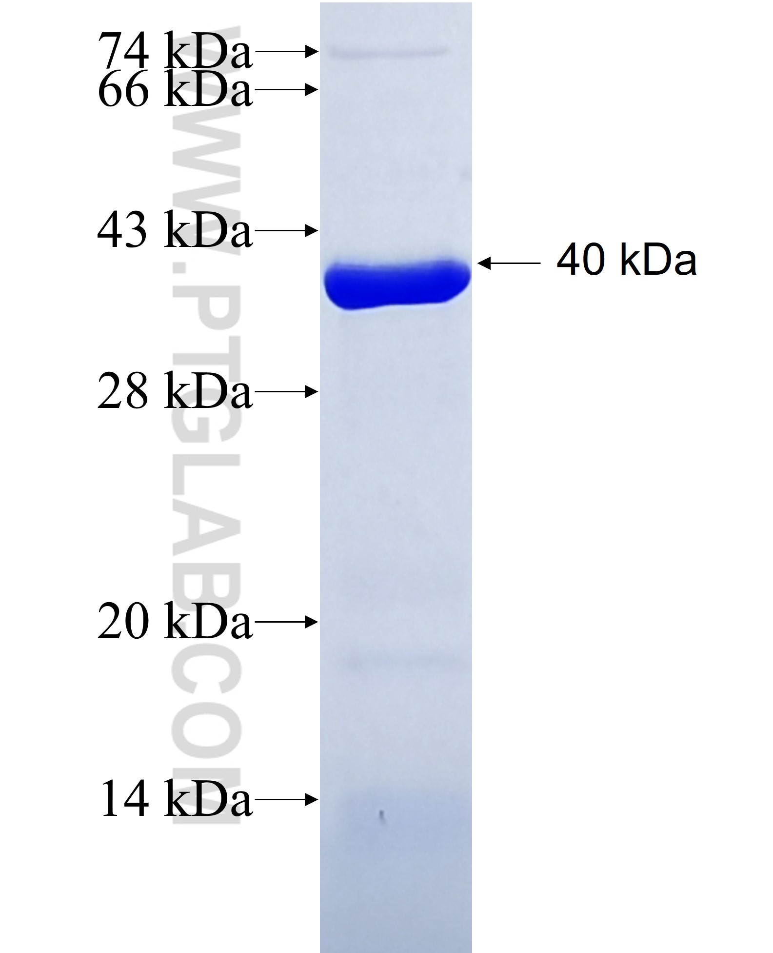 RIPK2 fusion protein Ag8276 SDS-PAGE