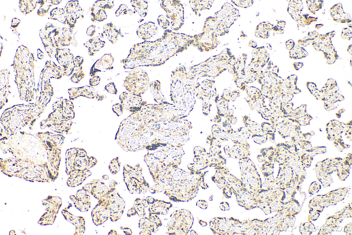 IHC staining of human placenta using 17563-1-AP