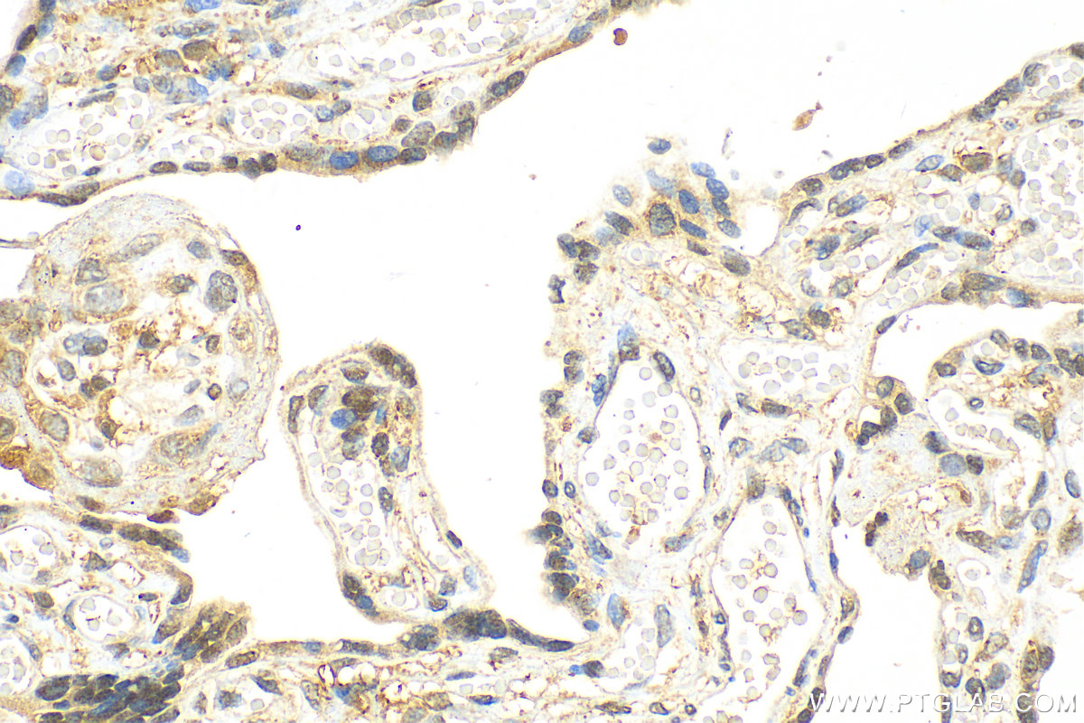 IHC staining of human placenta using 17563-1-AP