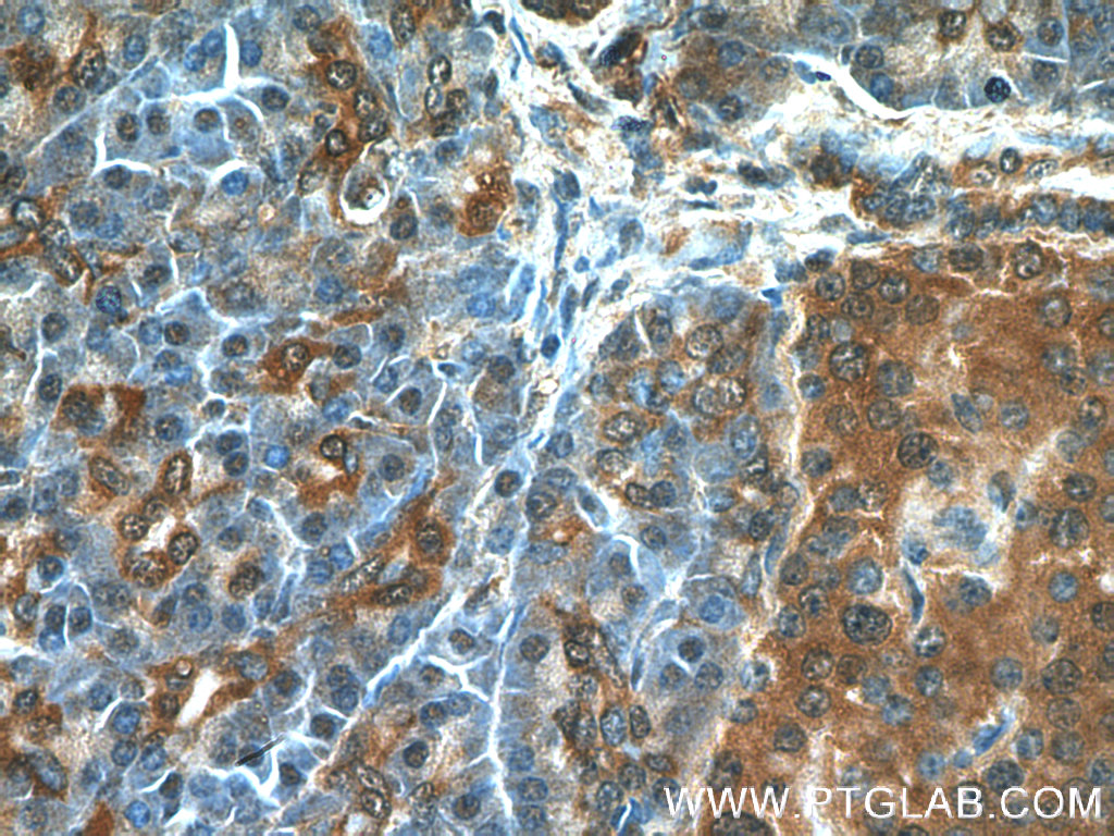 IHC staining of human pancreas using 17563-1-AP