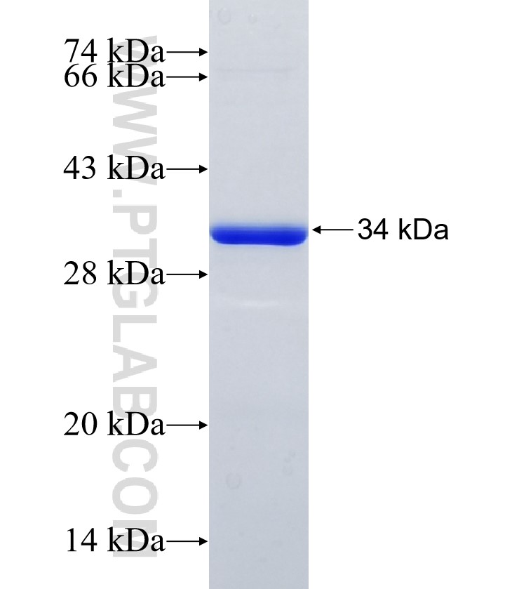 RIPK3 fusion protein Ag35708 SDS-PAGE RIPK3 fusion protein Ag35708 SDS-PAGE