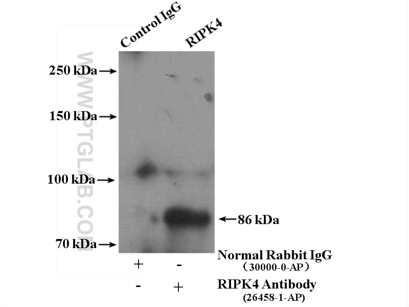 IP experiment of SKOV-3 using 26458-1-AP