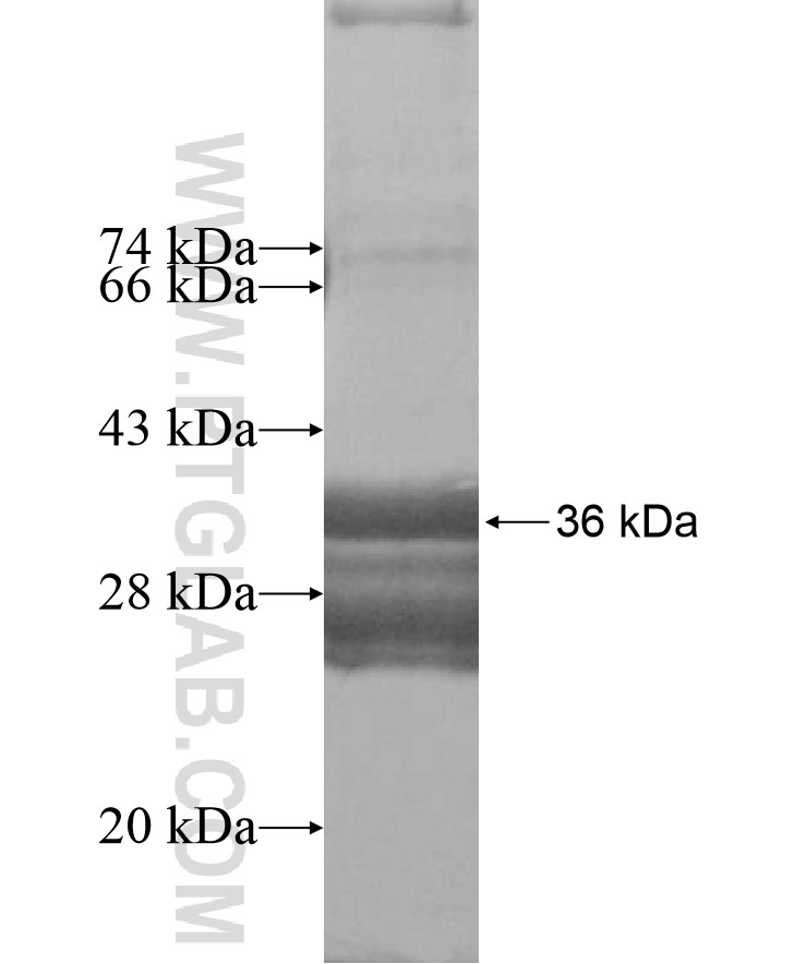 RIPPLY1 fusion protein Ag16438 SDS-PAGE RIPPLY1 fusion protein Ag16438 SDS-PAGE