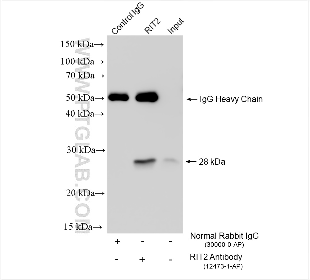 IP experiment of rat brain using 12473-1-AP