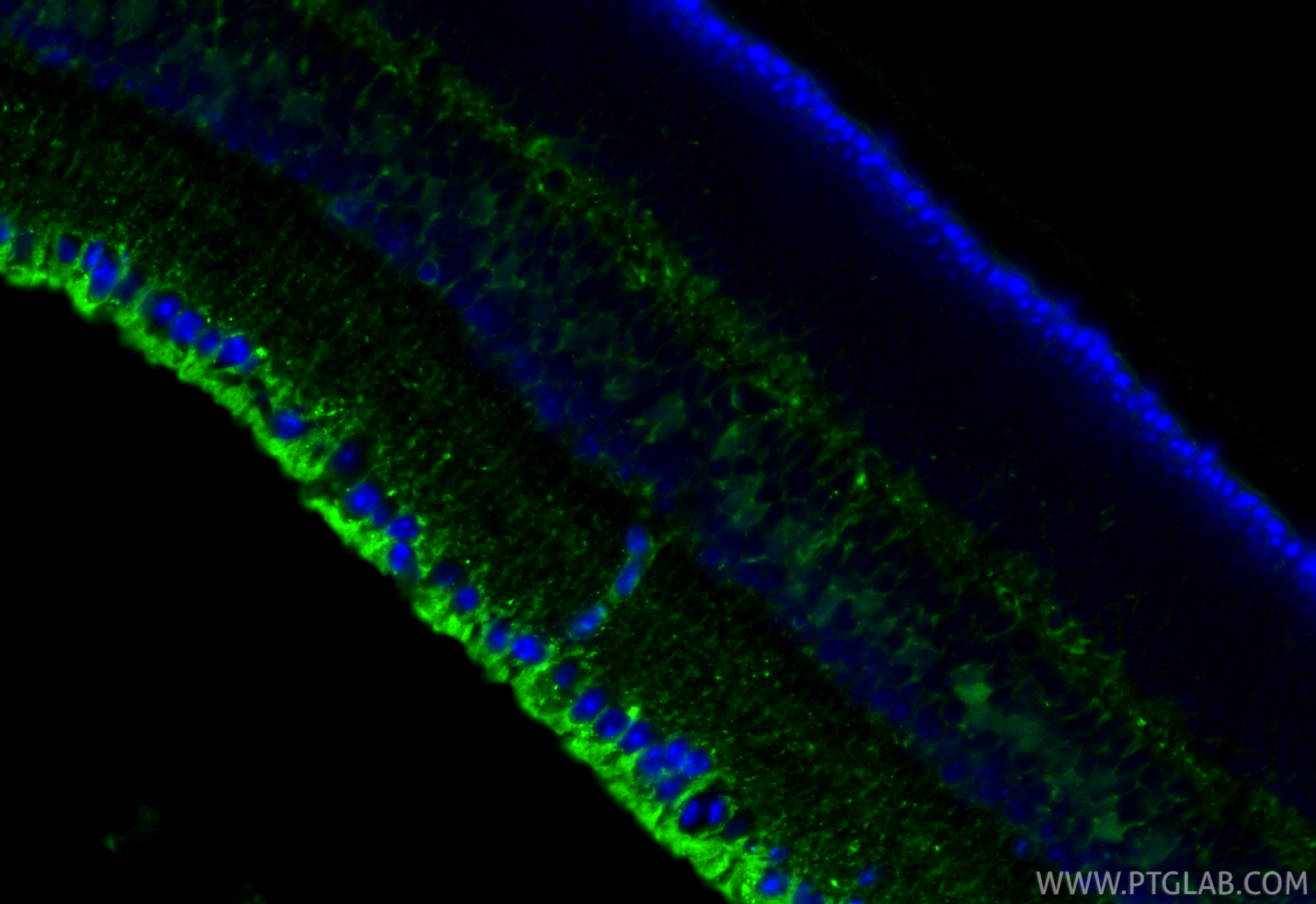 IF Staining of mouse eye using 85697-1-RR