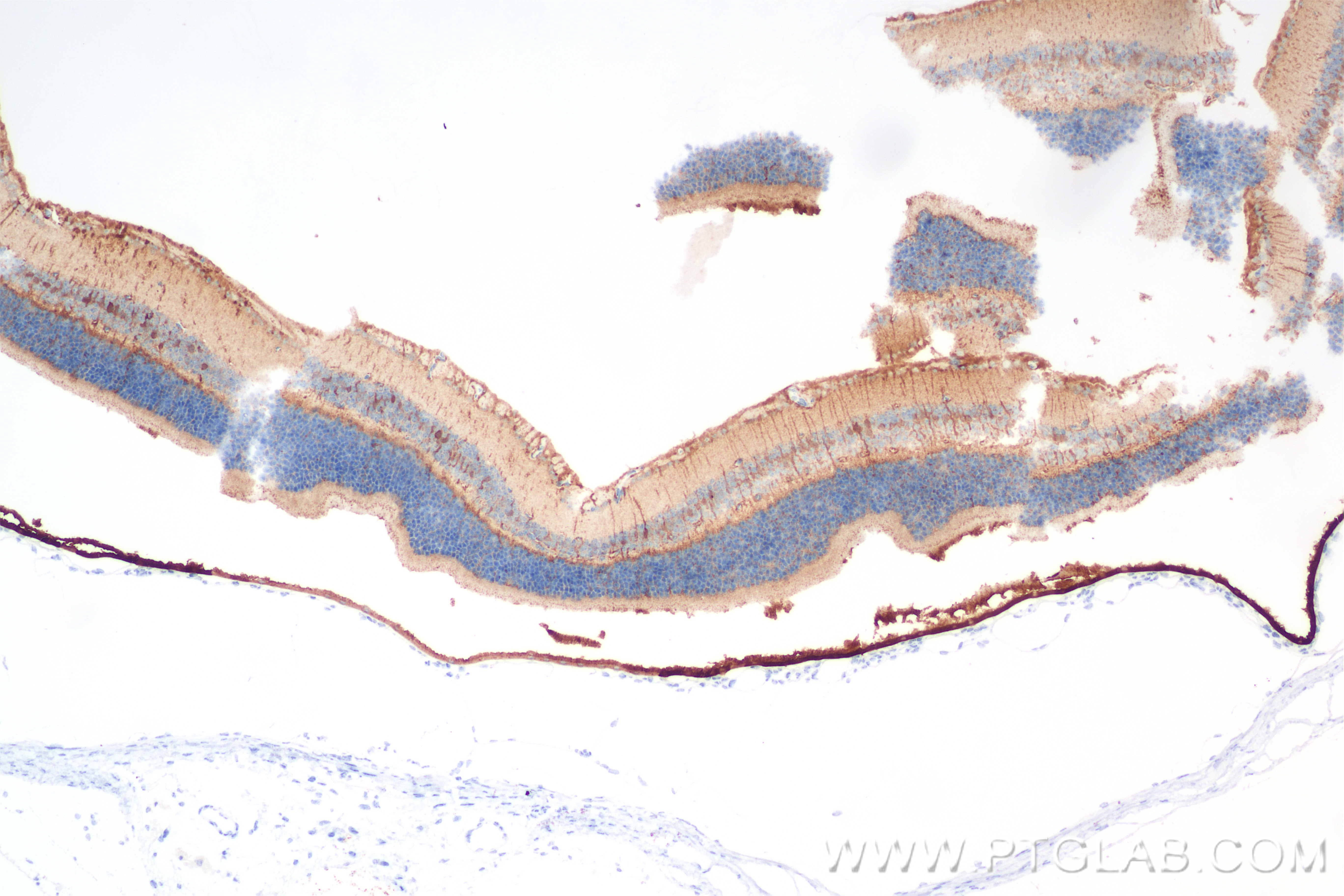 IHC staining of mouse eye using 85697-1-RR