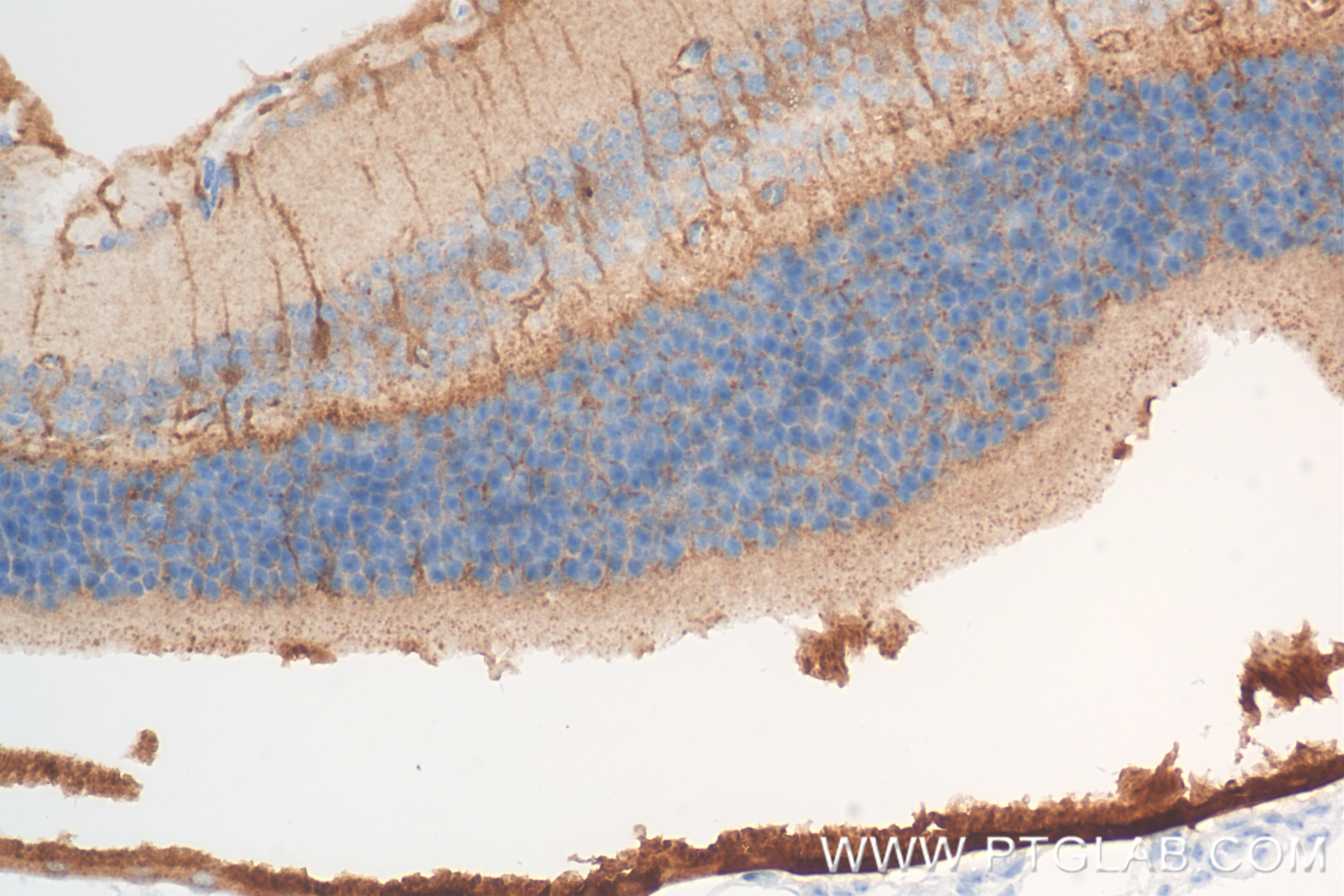 IHC staining of mouse eye using 85697-1-RR