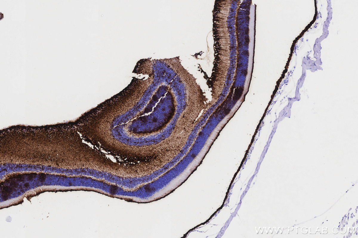IHC staining of mouse eye using 85697-1-RR