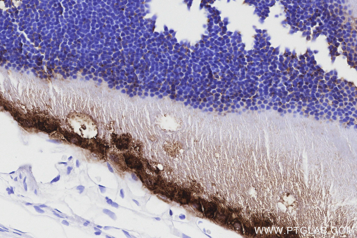 IHC staining of rat eye using 85697-1-RR