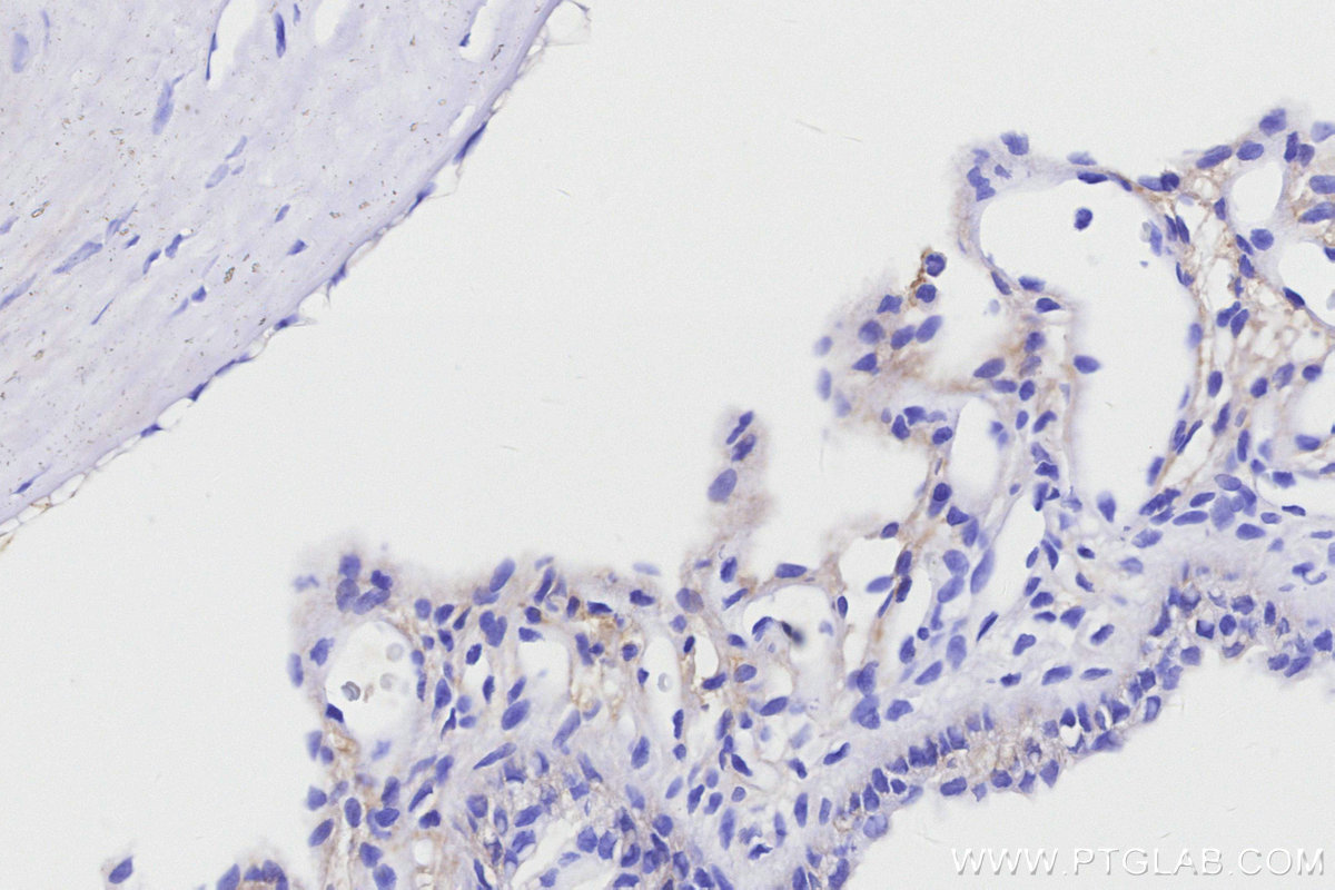 IHC staining of rat eye using 85697-1-RR