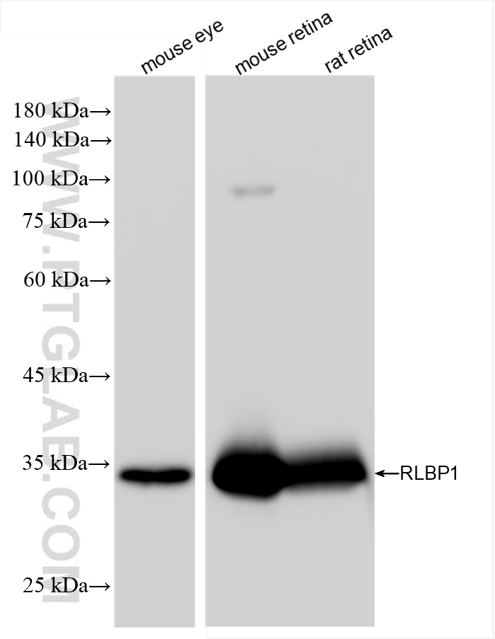 WB analysis using 85697-1-RR