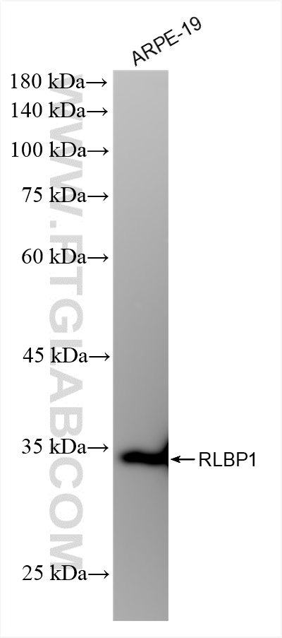 WB analysis of ARPE-19 using 85697-1-RR