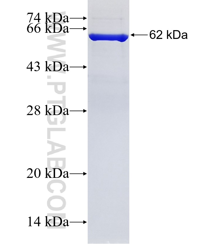 RLBP1 fusion protein Ag7602 SDS-PAGE