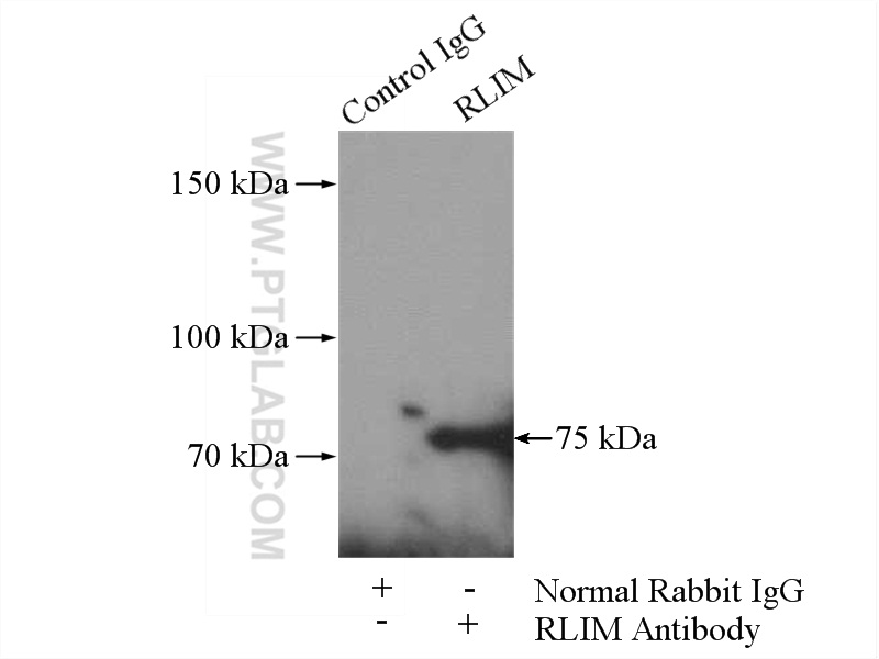 IP experiment of HeLa using 16121-1-AP