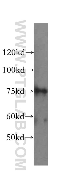 WB analysis of HeLa using 16121-1-AP