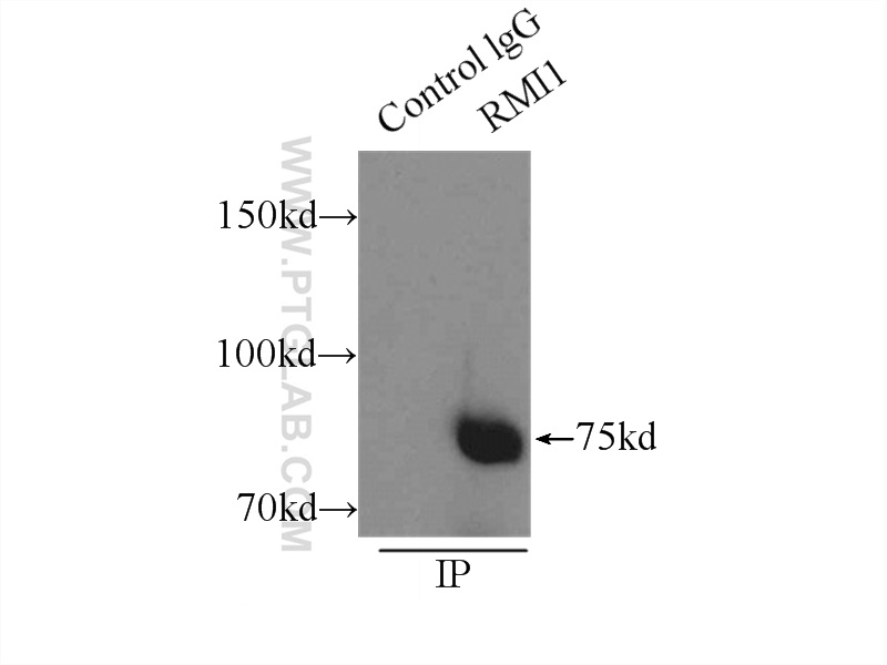 IP experiment of HeLa using 14630-1-AP