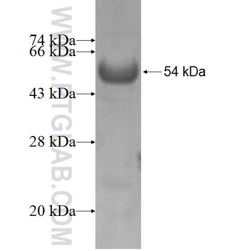 RMI1 fusion protein Ag6301 SDS-PAGE RMI1 fusion protein Ag6301 SDS-PAGE