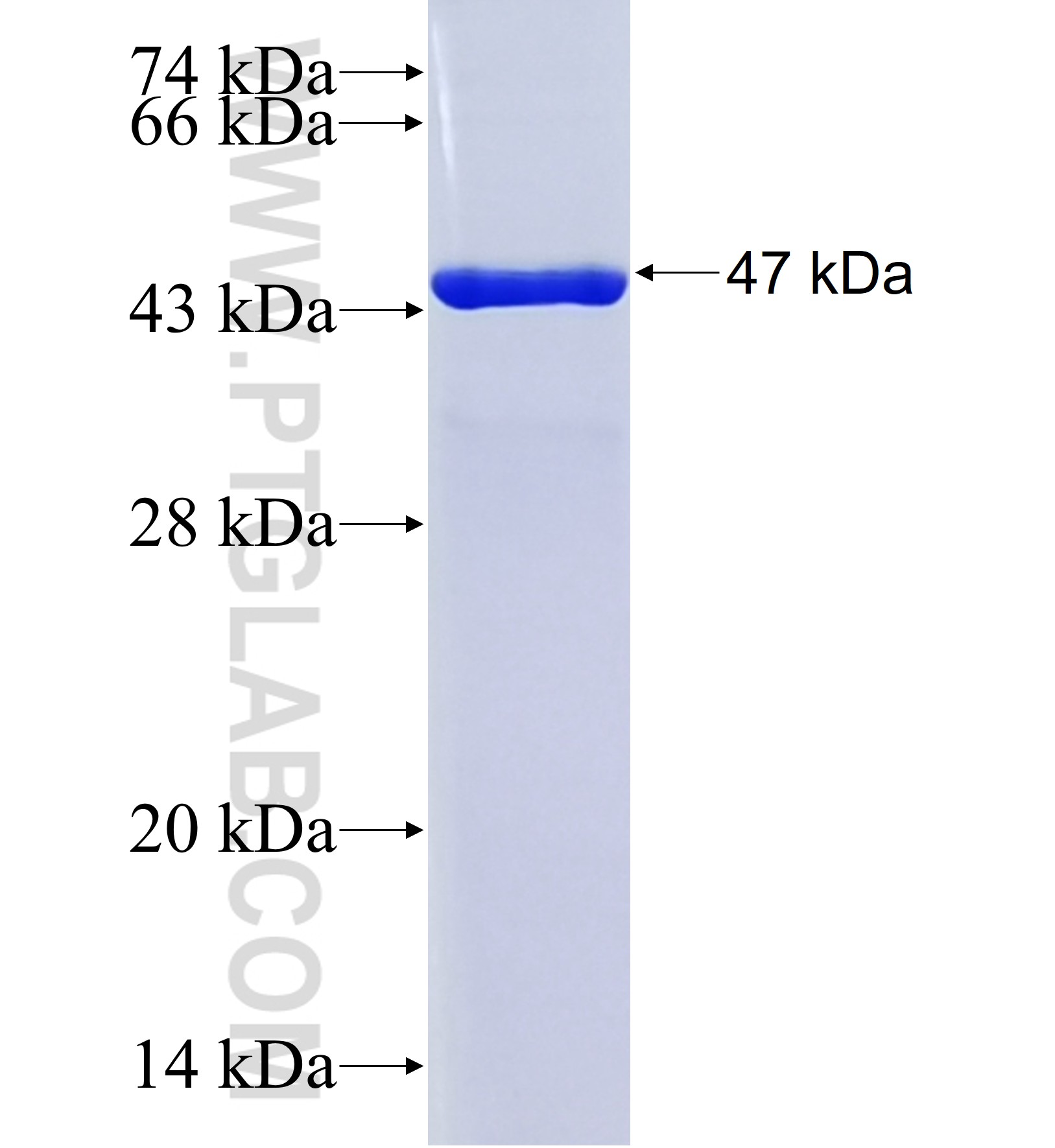RMND1 fusion protein Ag42024 SDS-PAGE RMND1 fusion protein Ag42024 SDS-PAGE