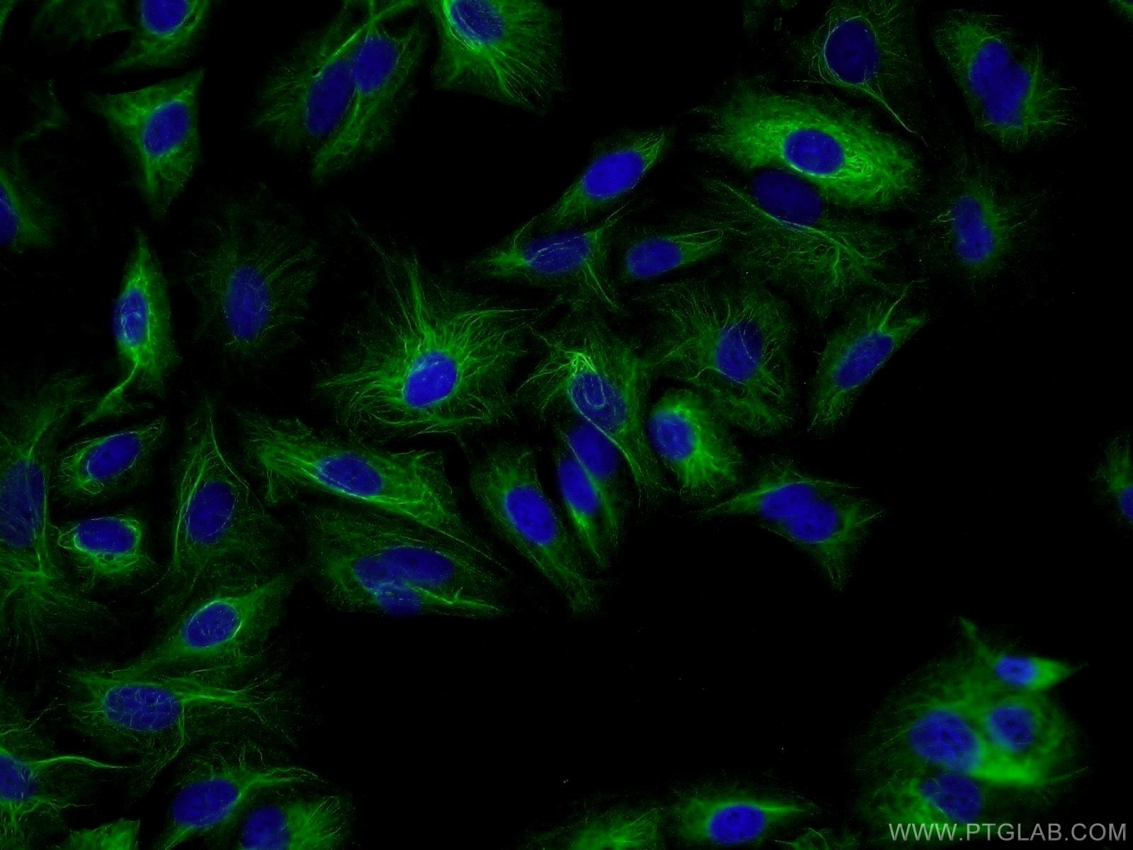 IF Staining of A549 using 25803-1-AP