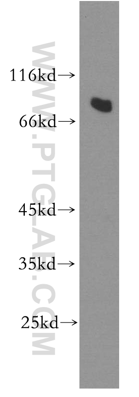 WB analysis of A549 using 11277-1-AP