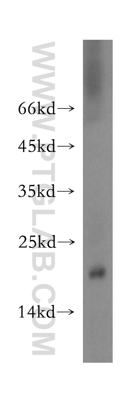 WB analysis of mouse liver using 18408-1-AP