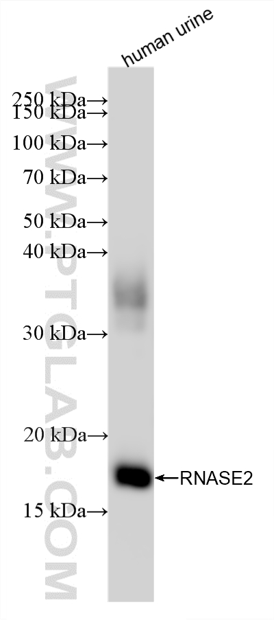 WB analysis of human urine using 88054-1-RR (same clone as 88054-1-PBS) WB analysis of human urine using 88054-1-RR (same clone as 88054-1-PBS)