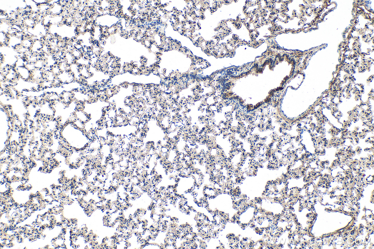 IHC staining of rat lung using 30732-1-AP